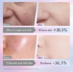 Sadoer NIACINAMIDE 10% - Imagen 5